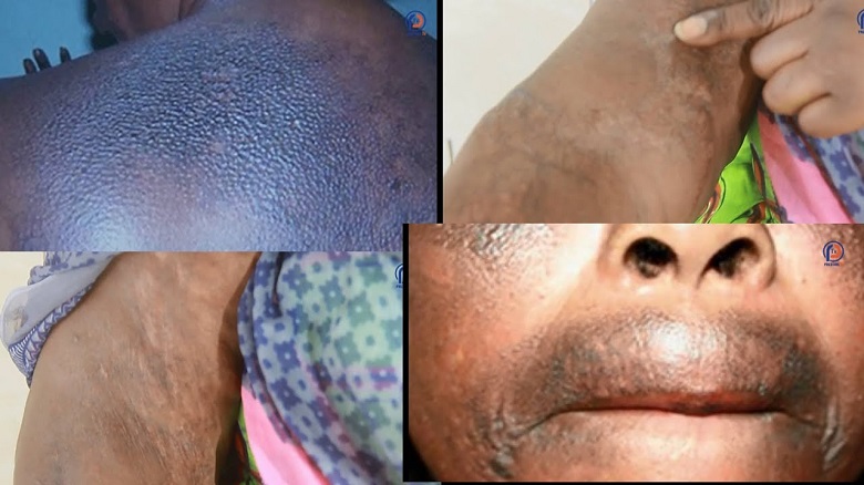 Xessal ou dépigmentation de la peau au Sénégal.