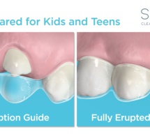 eric conley : "la version 12 de Spark donnent aux orthodontistes davantage de raisons de choisir les aligneurs clairs Spark pour leur cabinet et leurs patients"
